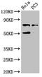 Galactosidase Beta 1 antibody, LS-C678086, Lifespan Biosciences, Western Blot image 