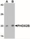 Paired Like Homeobox 2B antibody, NBP2-41179, Novus Biologicals, Western Blot image 