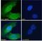 ATP Binding Cassette Subfamily G Member 2 (Junior Blood Group) antibody, 43-566, ProSci, Western Blot image 