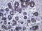 Cadherin 1 antibody, LS-C175433, Lifespan Biosciences, Immunohistochemistry paraffin image 