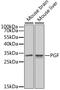 Placental Growth Factor antibody, A1727, ABclonal Technology, Western Blot image 