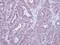 HCLS1-associated protein X-1 antibody, PA5-27592, Invitrogen Antibodies, Immunohistochemistry paraffin image 