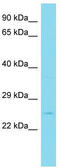 Hes Family BHLH Transcription Factor 7 antibody, TA329964, Origene, Western Blot image 