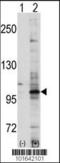 EPH Receptor A7 antibody, 63-047, ProSci, Western Blot image 