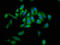 Nuclear Receptor Binding SET Domain Protein 2 antibody, LS-C673691, Lifespan Biosciences, Immunofluorescence image 