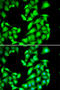 Protein Phosphatase, Mg2+/Mn2+ Dependent 1A antibody, STJ28782, St John