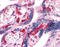 Hematopoietic Cell-Specific Lyn Substrate 1 antibody, 51-464, ProSci, Immunohistochemistry frozen image 
