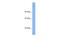 SIN3 Transcription Regulator Family Member B antibody, PA5-68785, Invitrogen Antibodies, Western Blot image 