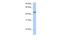 Ankyrin Repeat Domain 65 antibody, PA5-43104, Invitrogen Antibodies, Western Blot image 