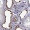 CLN2 antibody, NBP2-48820, Novus Biologicals, Immunohistochemistry paraffin image 