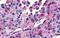 Arginine Vasopressin Receptor 1B antibody, NLS3737, Novus Biologicals, Immunohistochemistry paraffin image 