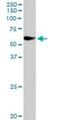 Eukaryotic Translation Initiation Factor 2 Alpha Kinase 1 antibody, H00027102-D01P, Novus Biologicals, Western Blot image 