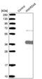 Ankyrin Repeat Domain 45 antibody, PA5-56811, Invitrogen Antibodies, Western Blot image 