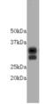 CD8 antibody, MBS857197, MyBioSource, Western Blot image 