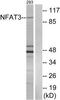 Nuclear factor of activated T-cells, cytoplasmic 4 antibody, TA311635, Origene, Western Blot image 