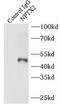 Neuronal Pentraxin 2 antibody, FNab05828, FineTest, Immunoprecipitation image 