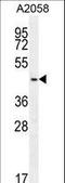 DDB1 And CUL4 Associated Factor 4 Like 2 antibody, LS-C160576, Lifespan Biosciences, Western Blot image 