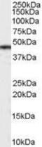 Casein Kinase 1 Delta antibody, GTX89349, GeneTex, Western Blot image 