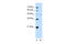 Solute Carrier Family 16 Member 1 antibody, 29-913, ProSci, Western Blot image 