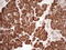 PYM Homolog 1, Exon Junction Complex Associated Factor antibody, LS-C790979, Lifespan Biosciences, Immunohistochemistry paraffin image 