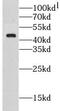 C-type lectin domain family 4 member M antibody, FNab01757, FineTest, Western Blot image 