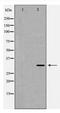 TNF Alpha Induced Protein 6 antibody, TA348042, Origene, Western Blot image 