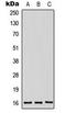 Midkine antibody, LS-C354027, Lifespan Biosciences, Western Blot image 