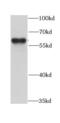 ADP Ribosylation Factor GTPase Activating Protein 3 antibody, FNab00538, FineTest, Western Blot image 