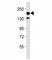 Erb-B2 Receptor Tyrosine Kinase 4 antibody, F53135-0.4ML, NSJ Bioreagents, Western Blot image 