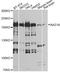 Bromodomain Adjacent To Zinc Finger Domain 1B antibody, A12545, ABclonal Technology, Western Blot image 