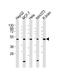 Protein Phosphatase 2 Regulatory Subunit Balpha antibody, M04159, Boster Biological Technology, Western Blot image 