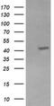 Potassium Voltage-Gated Channel Subfamily A Member Regulatory Beta Subunit 1 antibody, MA5-25789, Invitrogen Antibodies, Western Blot image 