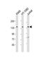 Formin 1 antibody, PA5-49490, Invitrogen Antibodies, Western Blot image 
