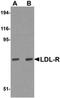 Low Density Lipoprotein Receptor antibody, orb75199, Biorbyt, Western Blot image 
