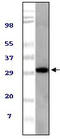 ASPSCR1 Tether For SLC2A4, UBX Domain Containing antibody, STJ98438, St John