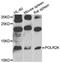 RNA Polymerase II Subunit K antibody, STJ111878, St John