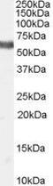 Nuclear Receptor Subfamily 4 Group A Member 1 antibody, GTX89206, GeneTex, Western Blot image 