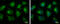 Enoyl-CoA hydratase, mitochondrial antibody, GTX114375, GeneTex, Immunofluorescence image 