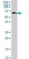 Kelch Like Family Member 25 antibody, H00064410-M09, Novus Biologicals, Western Blot image 