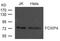 Forkhead Box P4 antibody, A07243-1, Boster Biological Technology, Western Blot image 