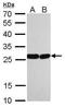 High Mobility Group Box 1 antibody, MA5-17277, Invitrogen Antibodies, Western Blot image 