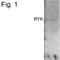 Receptor Like Tyrosine Kinase antibody, MA1-615, Invitrogen Antibodies, Western Blot image 