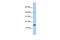 Sperm-associated antigen 11A antibody, GTX45472, GeneTex, Western Blot image 