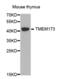 Transmembrane Protein 173 antibody, abx002586, Abbexa, Western Blot image 