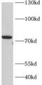 Double-stranded RNA-specific editase 1 antibody, FNab00151, FineTest, Western Blot image 