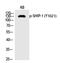 Inositol Polyphosphate-5-Phosphatase D antibody, PA5-40220, Invitrogen Antibodies, Western Blot image 