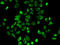 Hydroxy-Delta-5-Steroid Dehydrogenase, 3 Beta- And Steroid Delta-Isomerase 2 antibody, 18-323, ProSci, Immunofluorescence image 