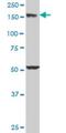 Early Endosome Antigen 1 antibody, H00008411-M03, Novus Biologicals, Western Blot image 