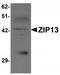 Solute Carrier Family 39 Member 13 antibody, TA320071, Origene, Western Blot image 