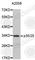 Cyclin Dependent Kinase 5 Regulatory Subunit 1 antibody, A0197, ABclonal Technology, Western Blot image 